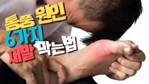 Read more about the article 통풍 진짜 원인은 퓨린 음식이 아닌 이 5가지다